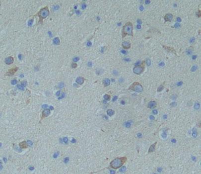 Polyclonal Antibody to Protein Tyrosine Phosphatase Receptor Type Z (PTPRZ)