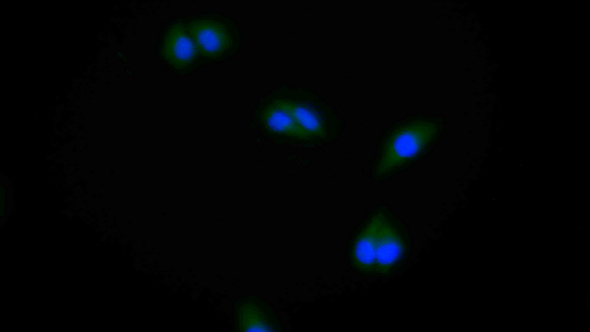 Polyclonal Antibody to Protein Tyrosine Phosphatase F Interacting Protein 1 (PPFIA1)