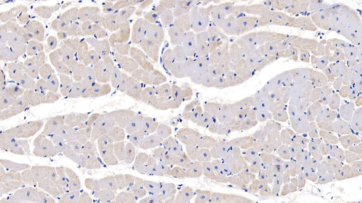 Polyclonal Antibody to Protein Tyrosine Phosphatase Type IVA 3 (PTP4A3)