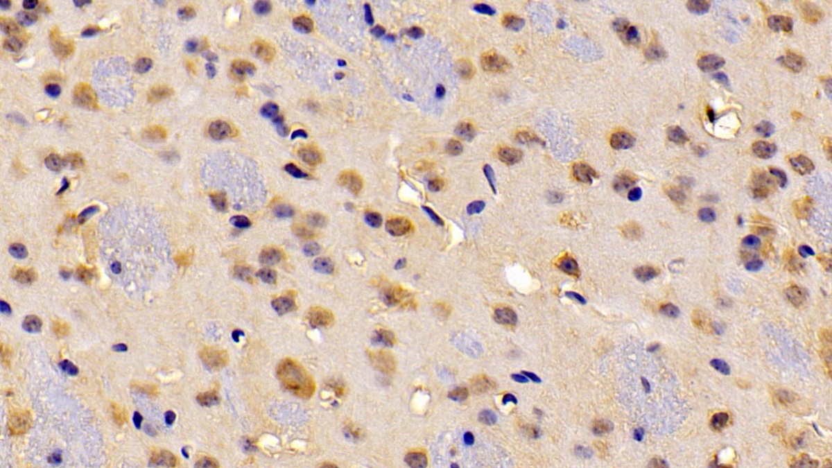 Polyclonal Antibody to ATP Binding Cassette Transporter A2 (ABCA2)