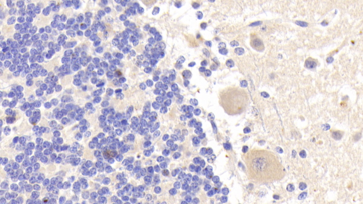 Polyclonal Antibody to ATP Binding Cassette Transporter E1 (ABCE1)