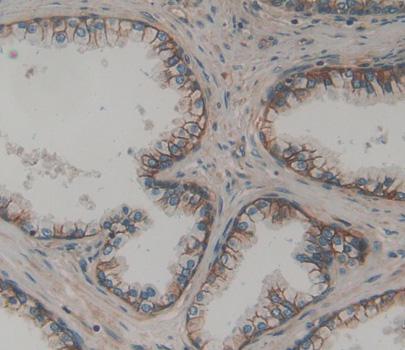 Polyclonal Antibody to ATP Binding Cassette Transporter C3 (ABCC3)