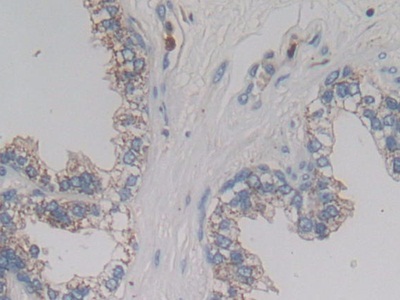 Polyclonal Antibody to ATP Binding Cassette Transporter C4 (ABCC4)