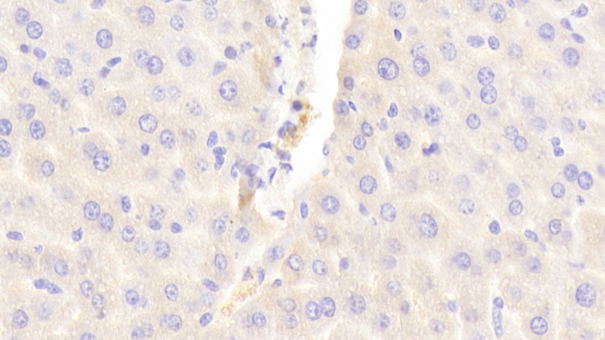 Polyclonal Antibody to ATP Binding Cassette Transporter C6 (ABCC6)