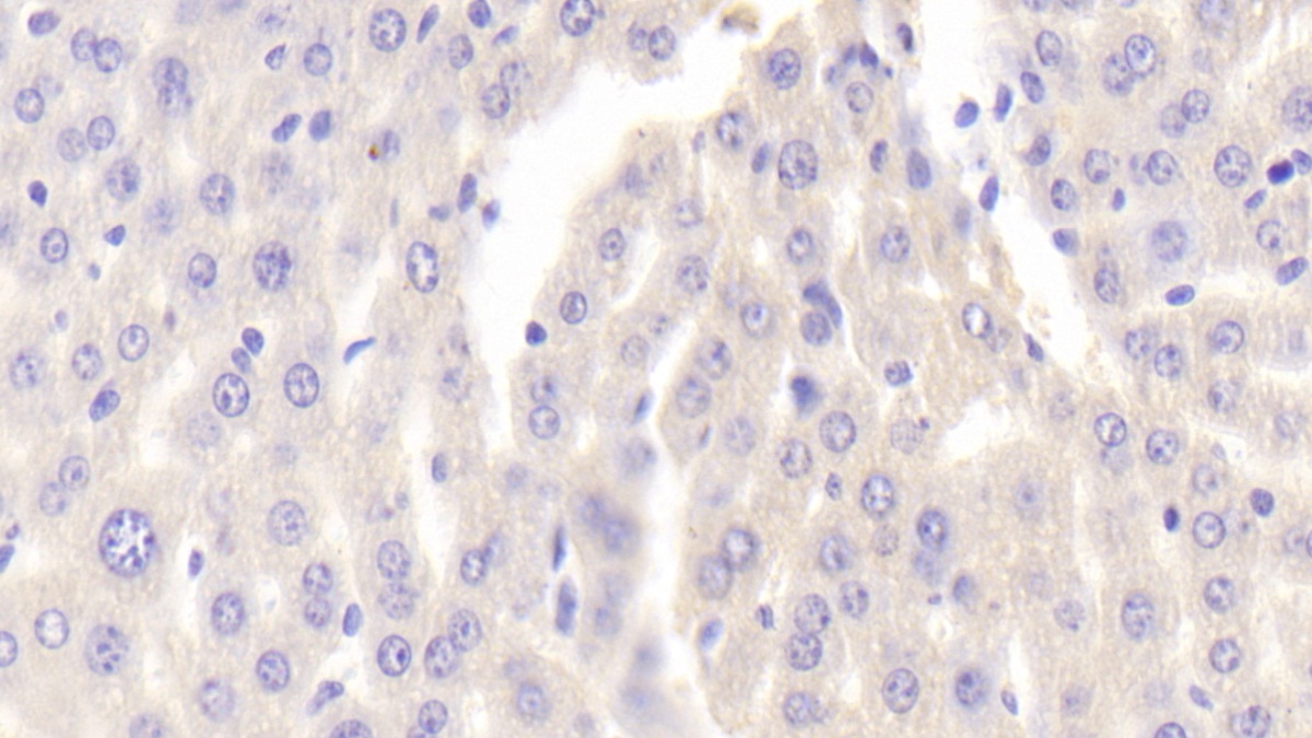 Polyclonal Antibody to ATP Binding Cassette Transporter C11 (ABCC11)