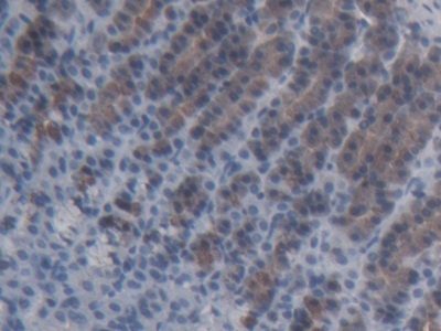 Polyclonal Antibody to ATP Binding Cassette Transporter C11 (ABCC11)