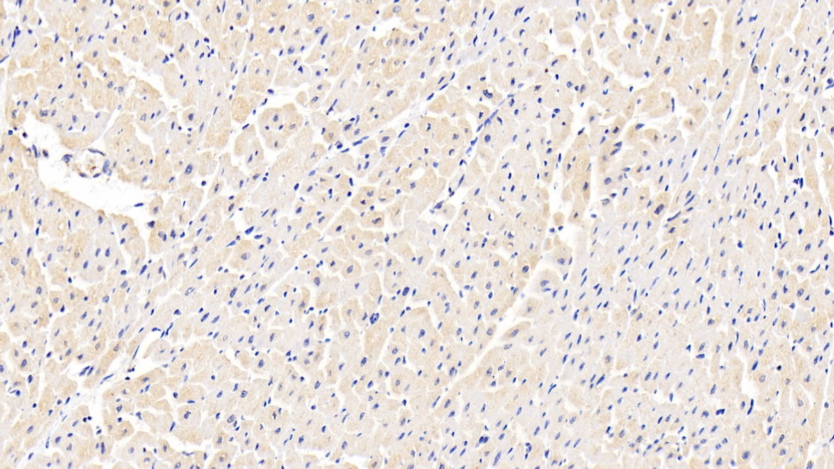 Polyclonal Antibody to ATP Binding Cassette Transporter B8 (ABCB8)