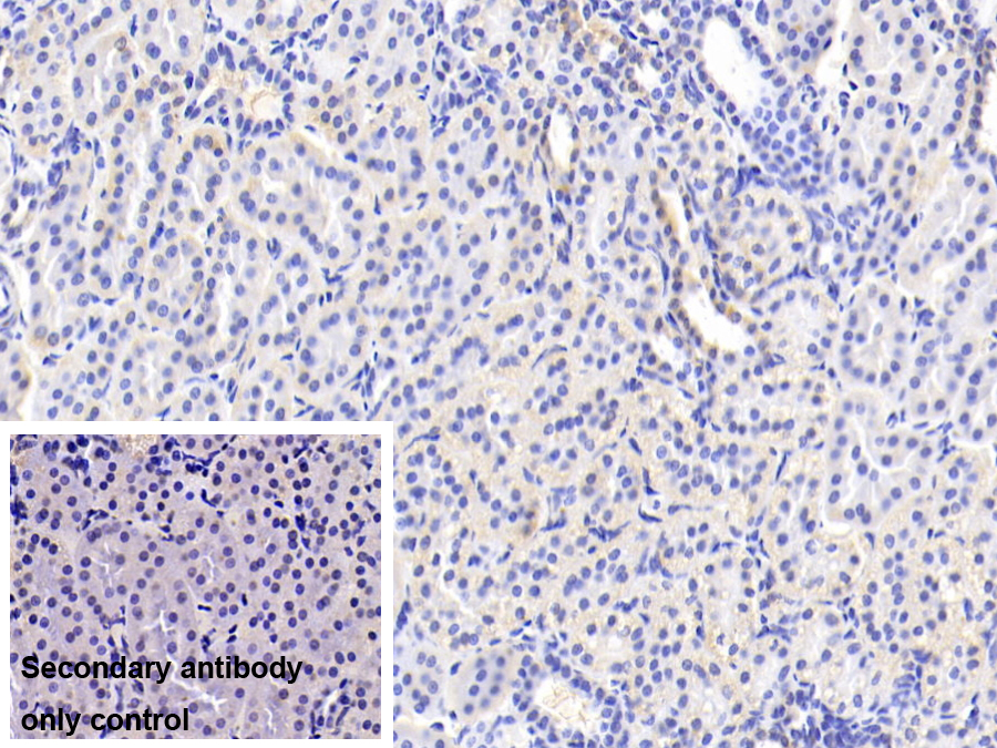 Polyclonal Antibody to ATP Binding Cassette Transporter B10 (ABCB10)