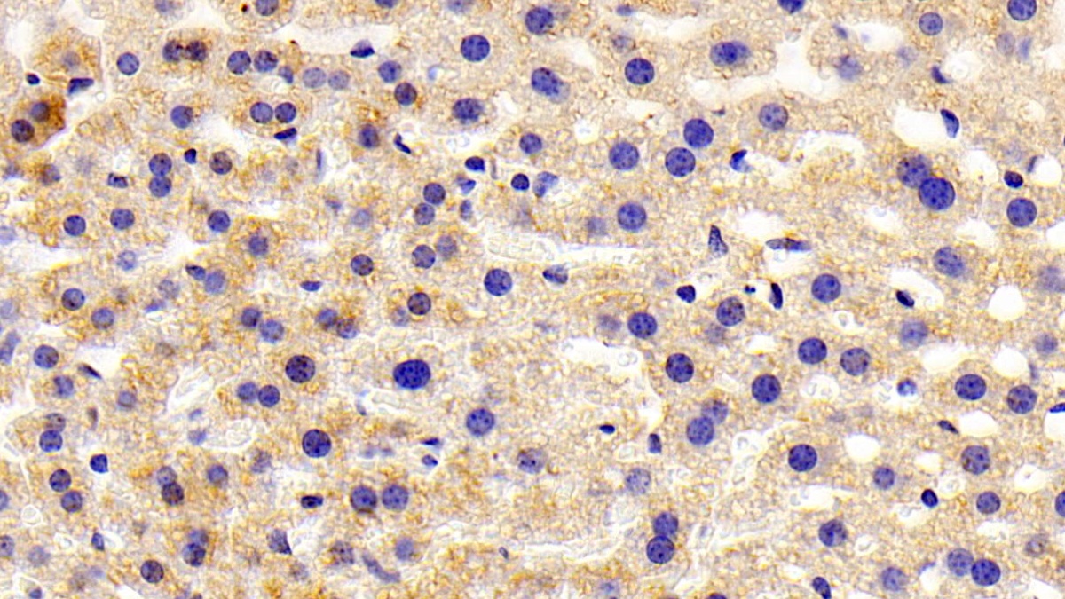 Polyclonal Antibody to ATP Binding Cassette Transporter F1 (ABCF1)