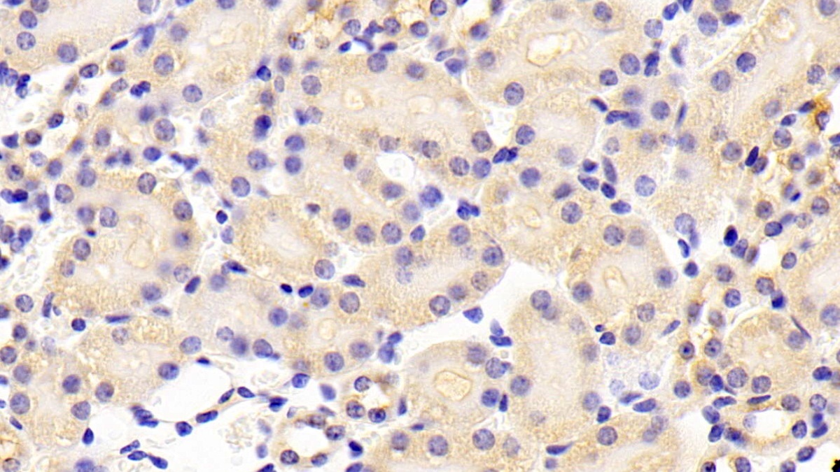 Polyclonal Antibody to ATP Binding Cassette Transporter A5 (ABCA5)