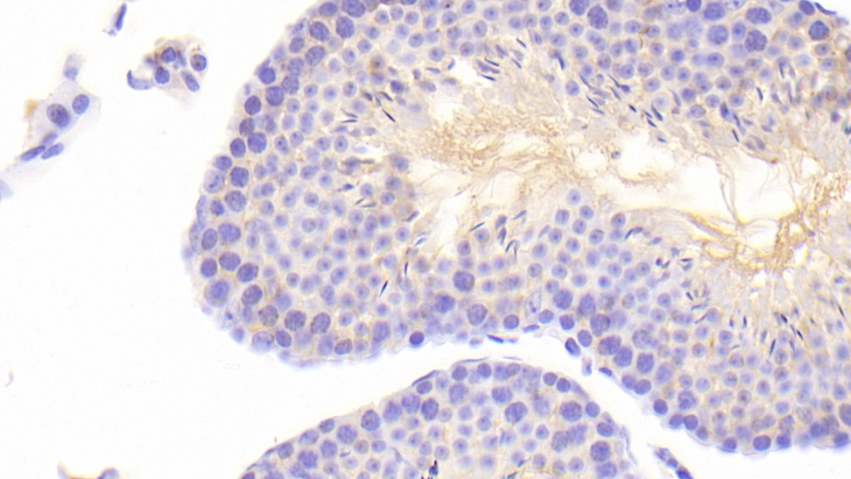 Polyclonal Antibody to ATP Binding Cassette Transporter A6 (ABCA6)