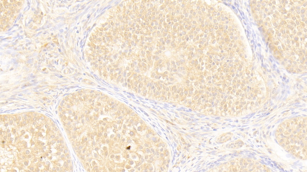 Polyclonal Antibody to ATP Binding Cassette Transporter A8 (ABCA8)