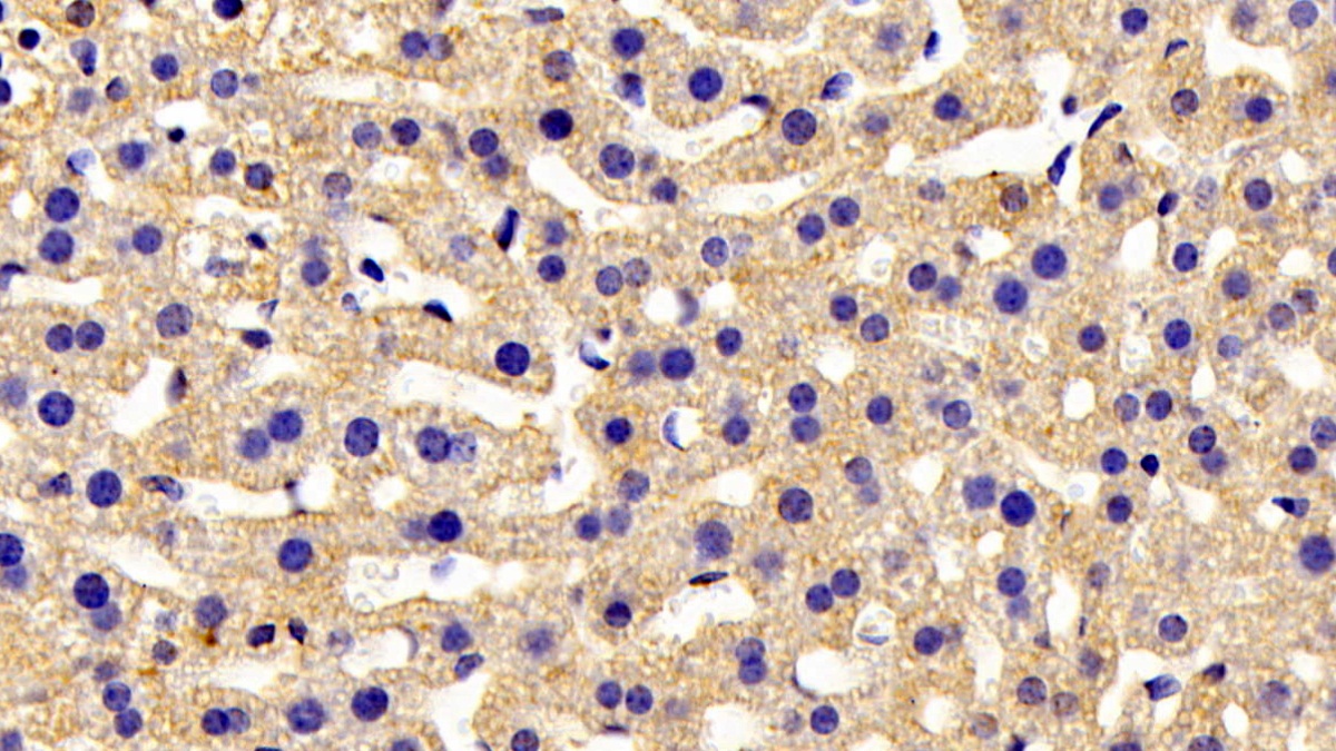 Polyclonal Antibody to ATP Binding Cassette Transporter A8 (ABCA8)