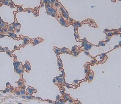 Polyclonal Antibody to ATP Binding Cassette Transporter A8 (ABCA8)