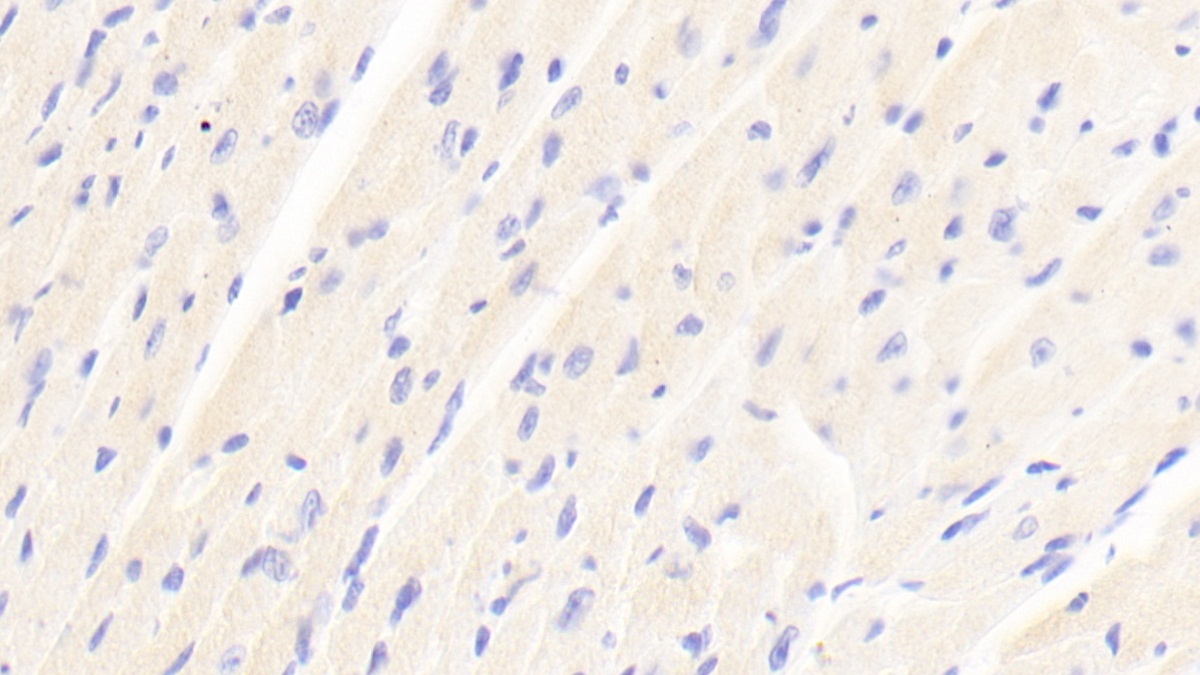 Polyclonal Antibody to ATP Binding Cassette Transporter D2 (ABCD2)