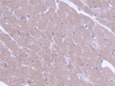 Polyclonal Antibody to ATP Binding Cassette Transporter G8 (ABCG8)