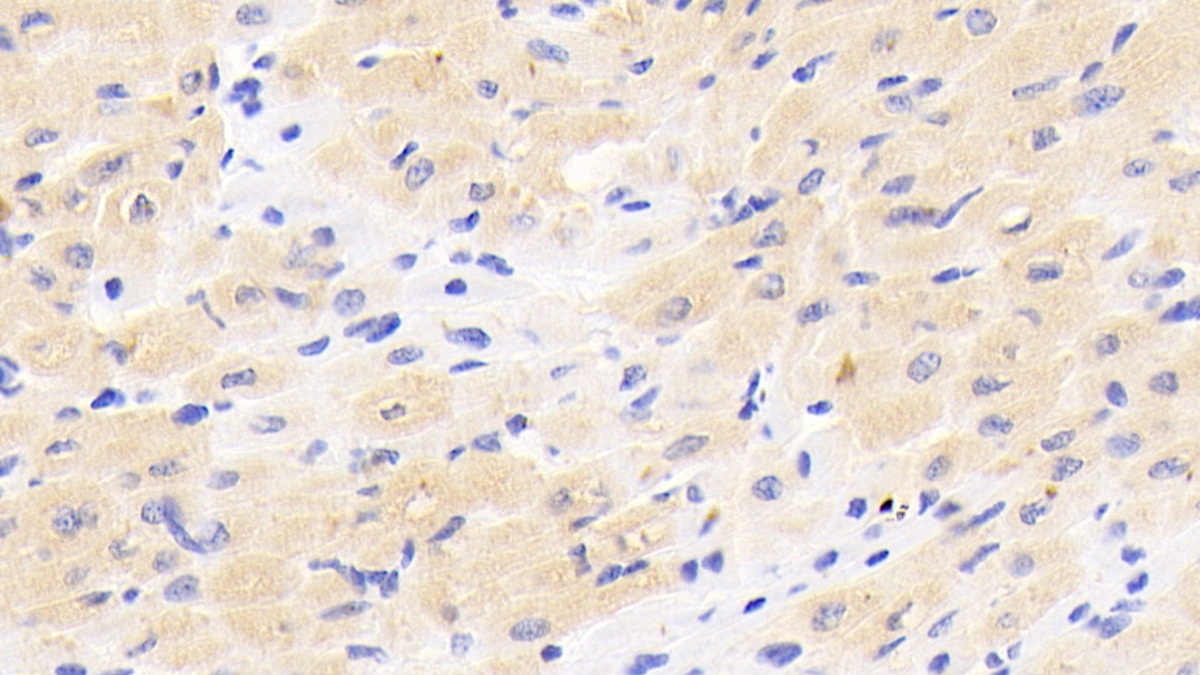 Polyclonal Antibody to ATP Binding Cassette Transporter G4 (ABCG4)