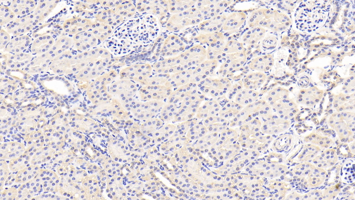 Polyclonal Antibody to Acetyl Coenzyme A Acyltransferase 2 (ACAA2)