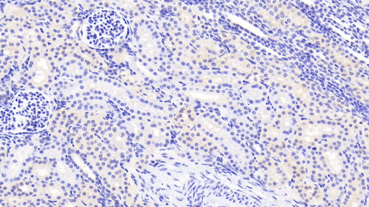 Polyclonal Antibody to Acetyl Coenzyme A Carboxylase Beta (ACACb)