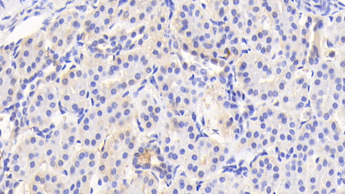 Polyclonal Antibody to Acetyl Coenzyme A Acetyltransferase 1 (ACAT1)