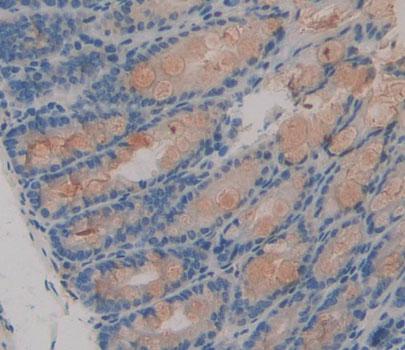 Polyclonal Antibody to Coenzyme A Synthase (COASY)