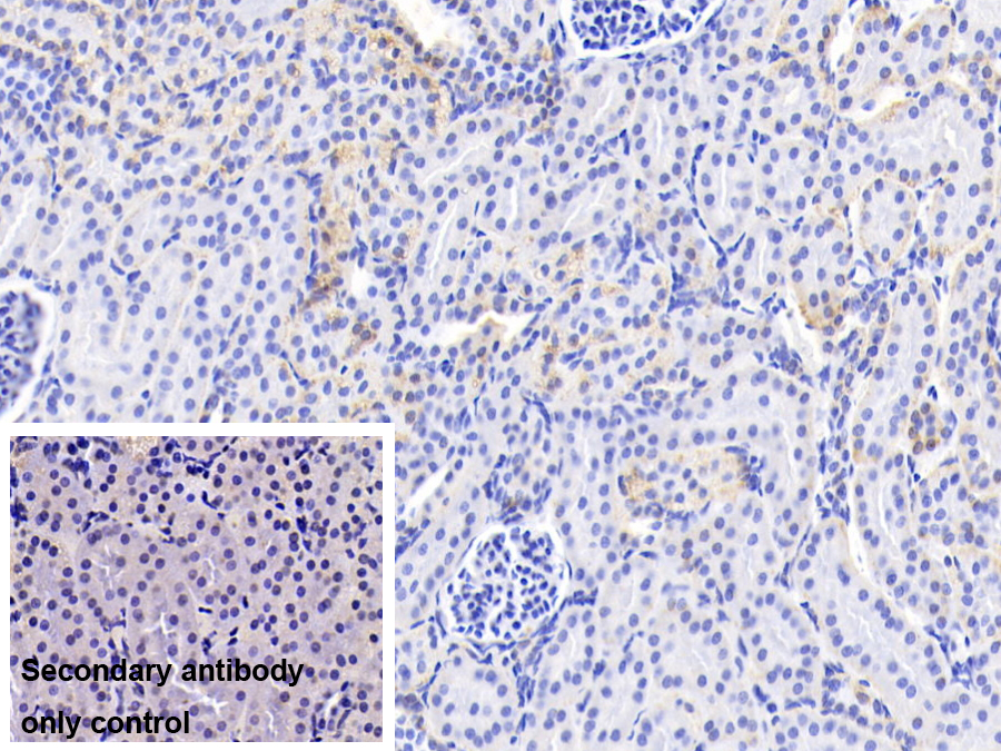 Polyclonal Antibody to Glutaryl Coenzyme A Dehydrogenase (GCDH)