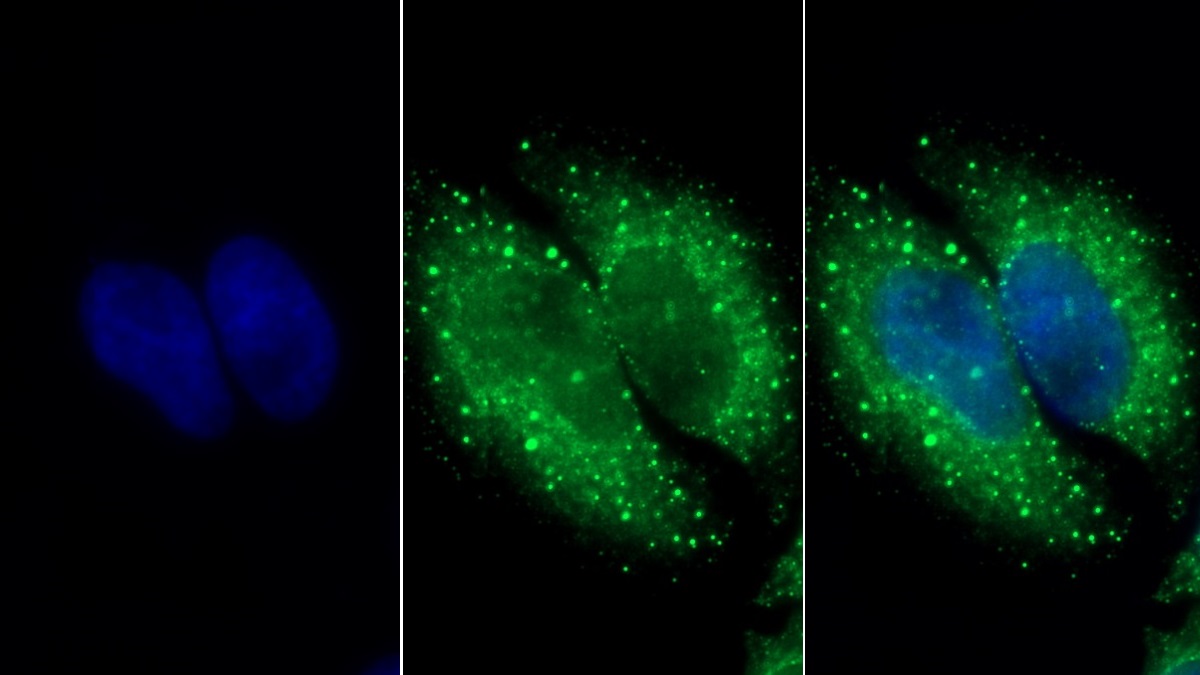 Polyclonal Antibody to Hydroxyacyl Coenzyme A Dehydrogenase (HADH)