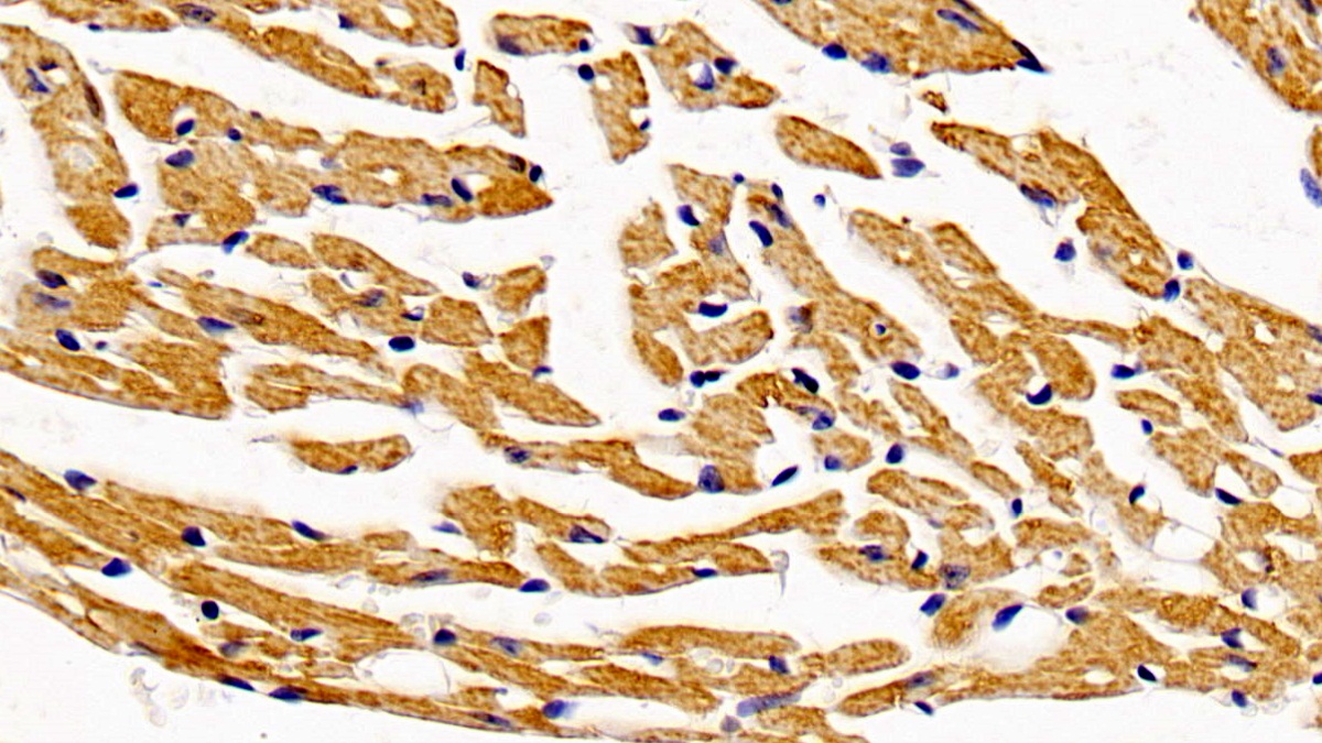 Polyclonal Antibody to Hydroxyacyl Coenzyme A Dehydrogenase (HADH)