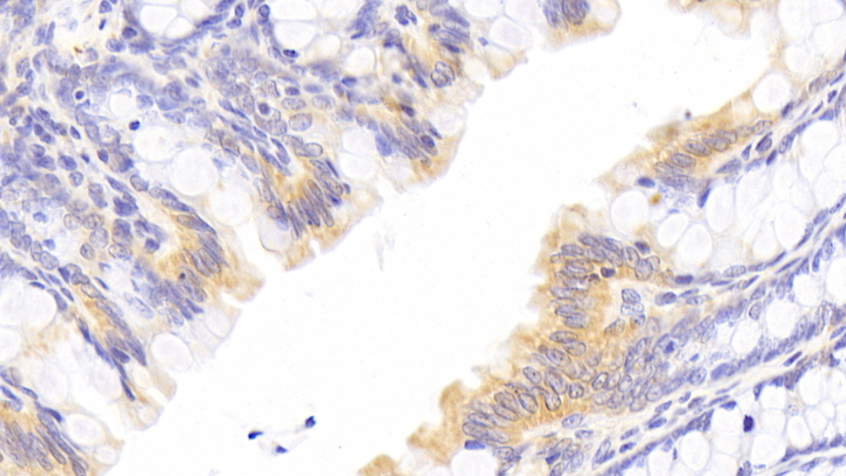 Polyclonal Antibody to 3-Hydroxy-3-Methylglutaryl Coenzyme A Reductase (HMGCR)