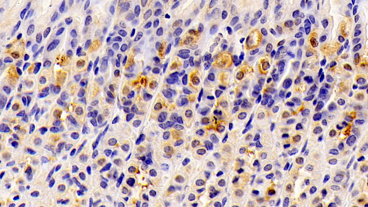 Polyclonal Antibody to Hydroxymethylglutaryl Coenzyme A Synthase 2, Mitochondrial (HMGCS2)