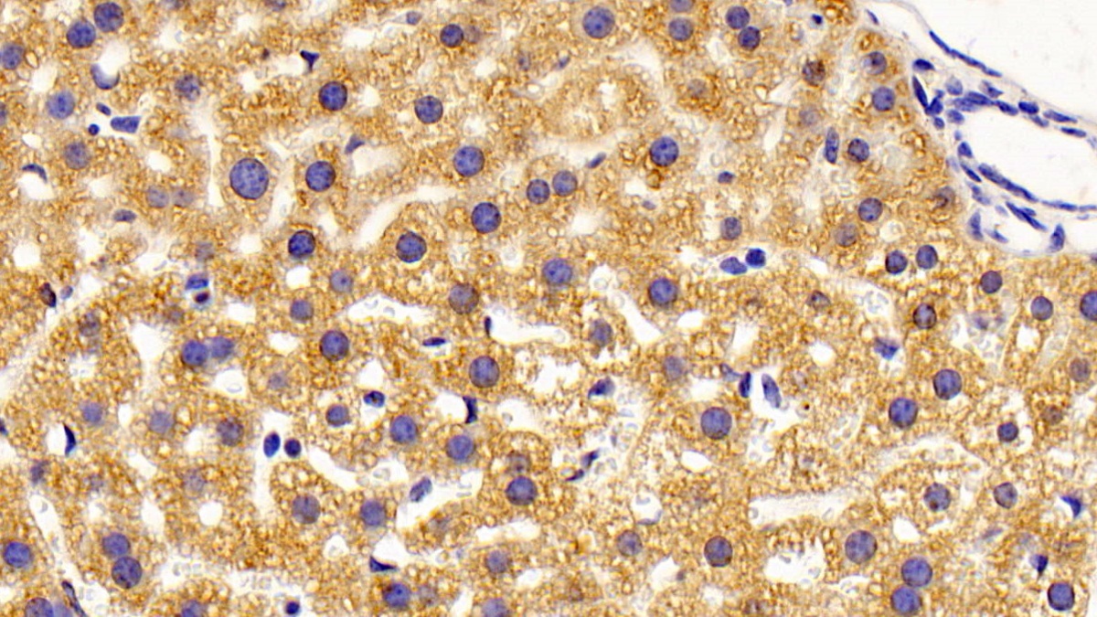 Polyclonal Antibody to Isovaleryl Coenzyme A Dehydrogenase (IVD)