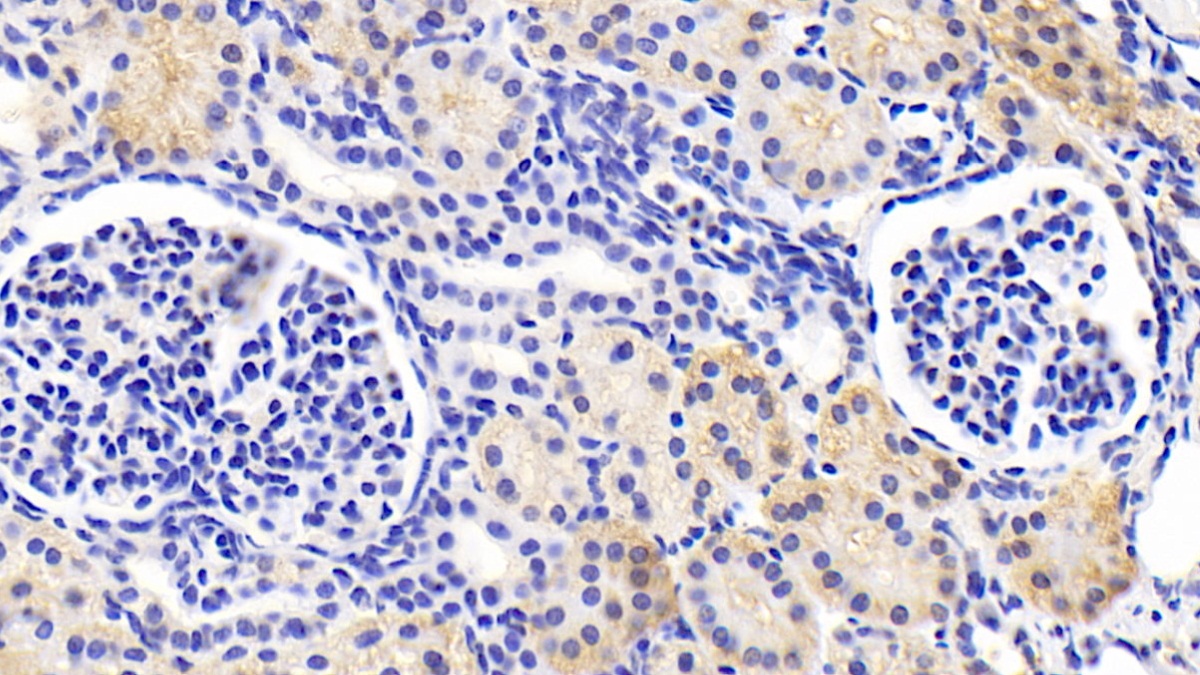 Polyclonal Antibody to Methylcrotonoyl Coenzyme A Carboxylase 2 (MCCC2)