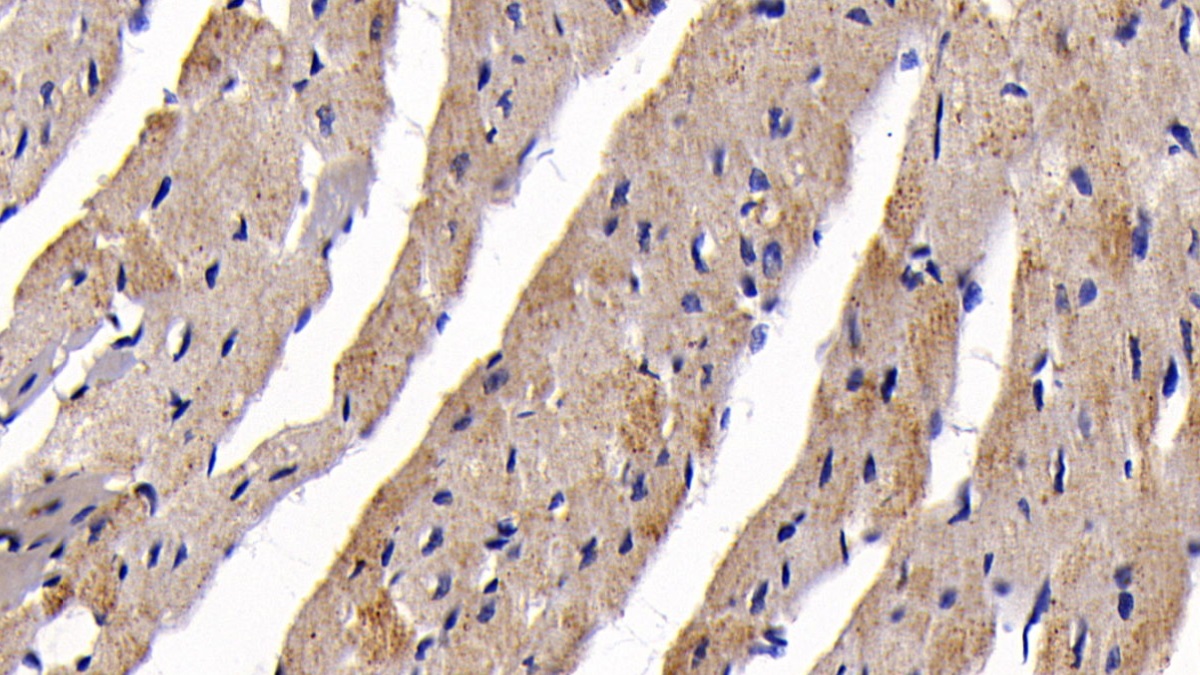 Polyclonal Antibody to Propionyl Coenzyme A Carboxylase Alpha (PCCa)