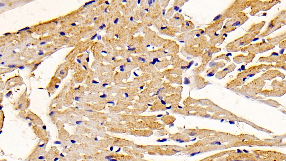 Polyclonal Antibody to Peroxisomal D3, D2-Enoyl Coenzyme A Isomerase (PECI)