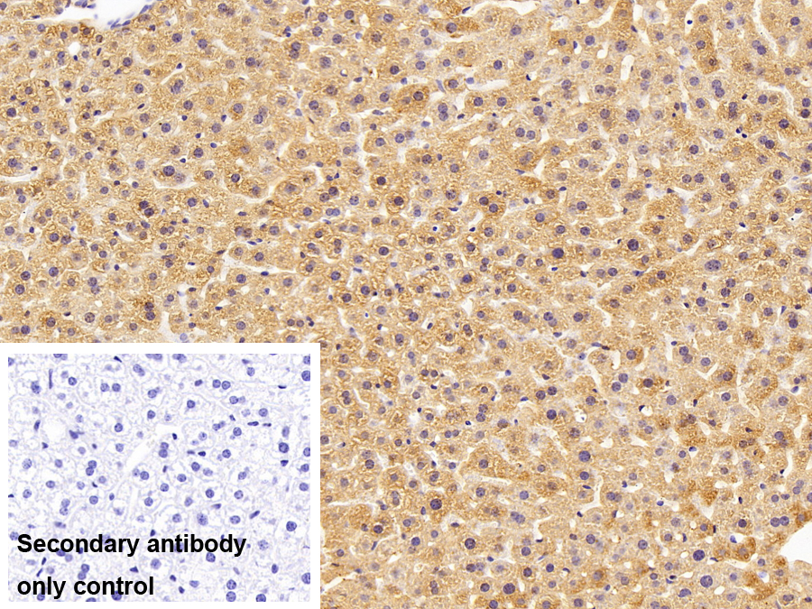 Polyclonal Antibody to Diazepam Binding Inhibitor (DBI)