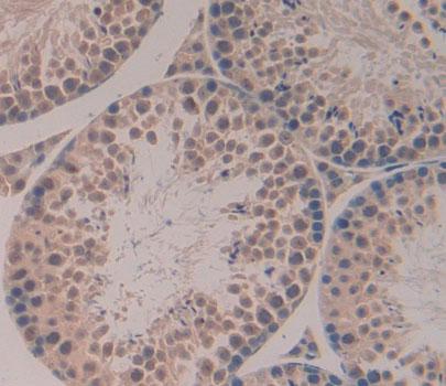 Polyclonal Antibody to Regulator Of G Protein Signaling 3 (RGS3)