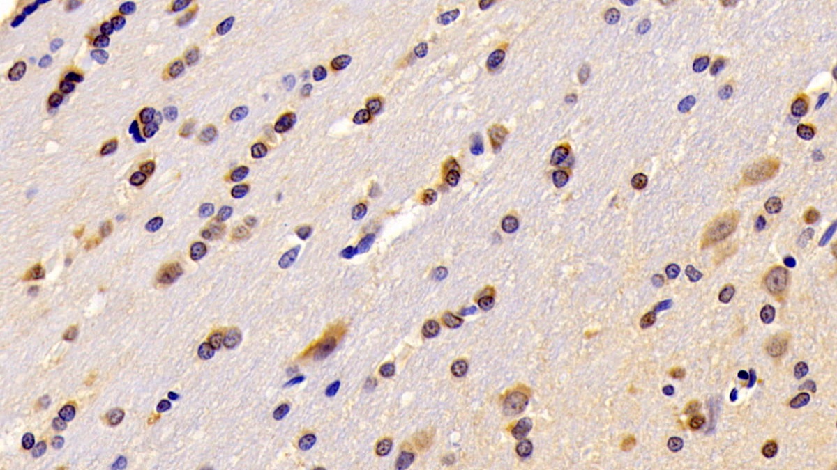 Polyclonal Antibody to Regulator Of G Protein Signaling 6 (RGS6)