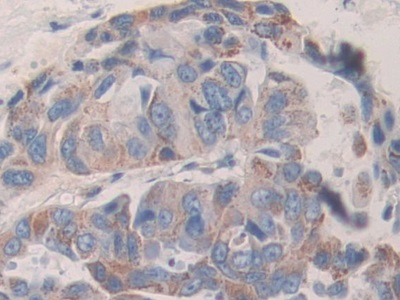 Polyclonal Antibody to Killer Cell Immunoglobulin Like Receptor 2DL2 (KIR2DL2)