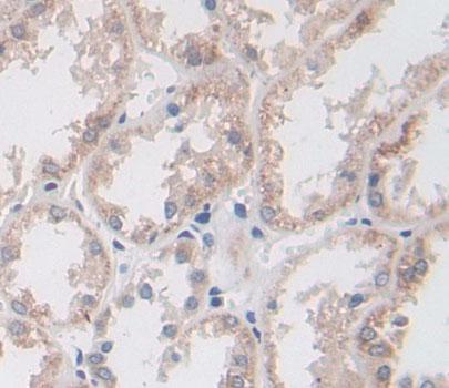 Polyclonal Antibody to Bisphosphoglycerate Mutase (BPGM)