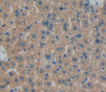 Polyclonal Antibody to Bisphosphoglycerate Mutase (BPGM)