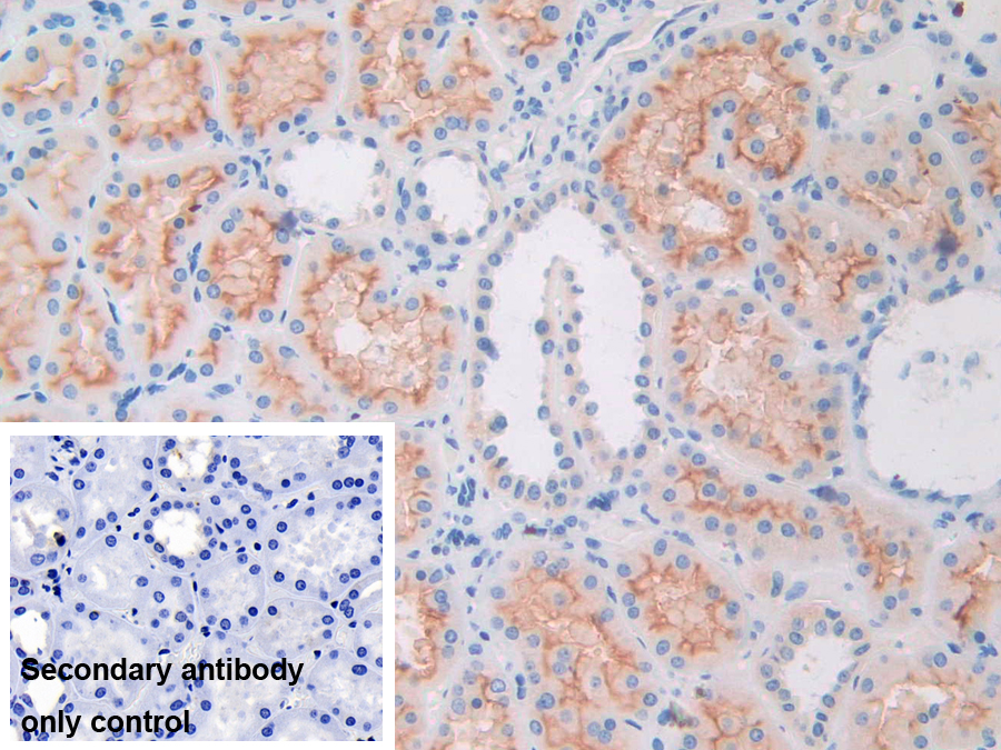 Polyclonal Antibody to Apolipoprotein L (APOL1)