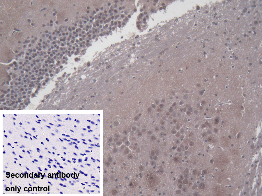 Polyclonal Antibody to Pyruvate Dehydrogenase Phosphatase 2 (PDP2)