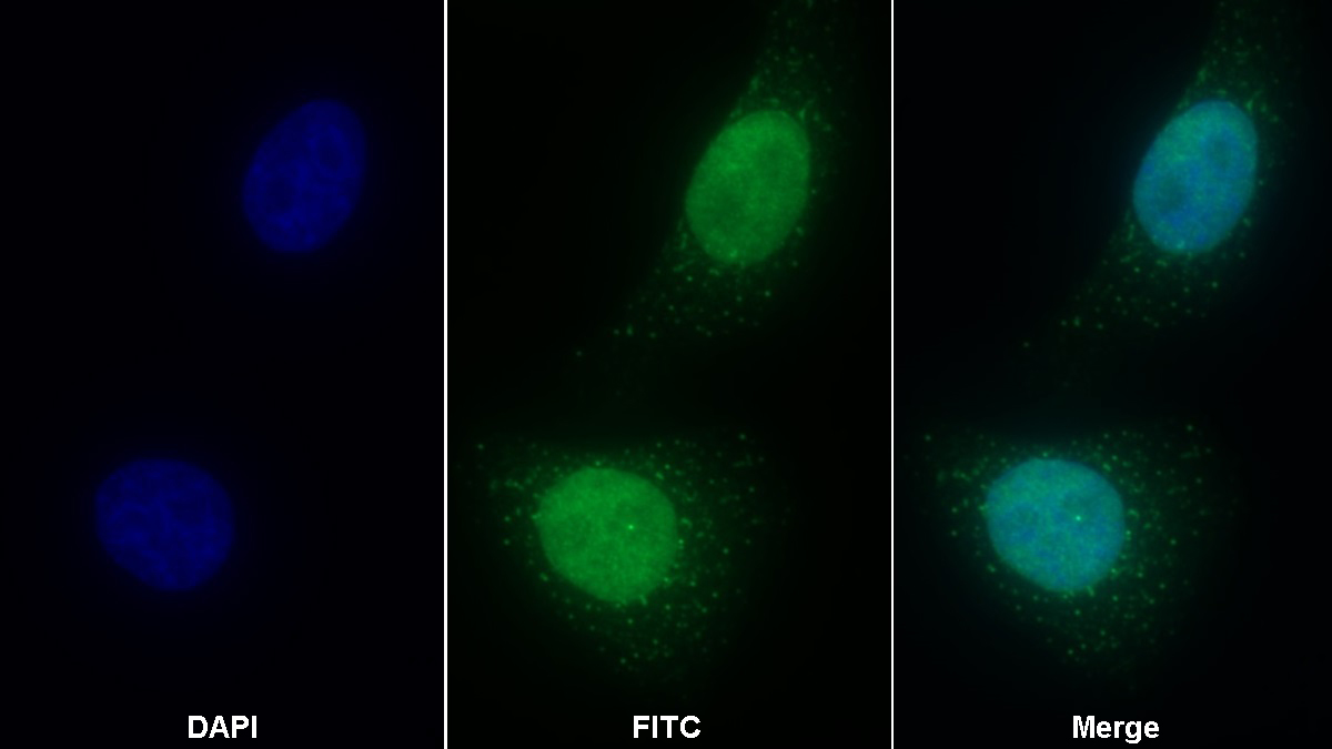 Polyclonal Antibody to Lipolysis Stimulated Lipoprotein Receptor (LSR)