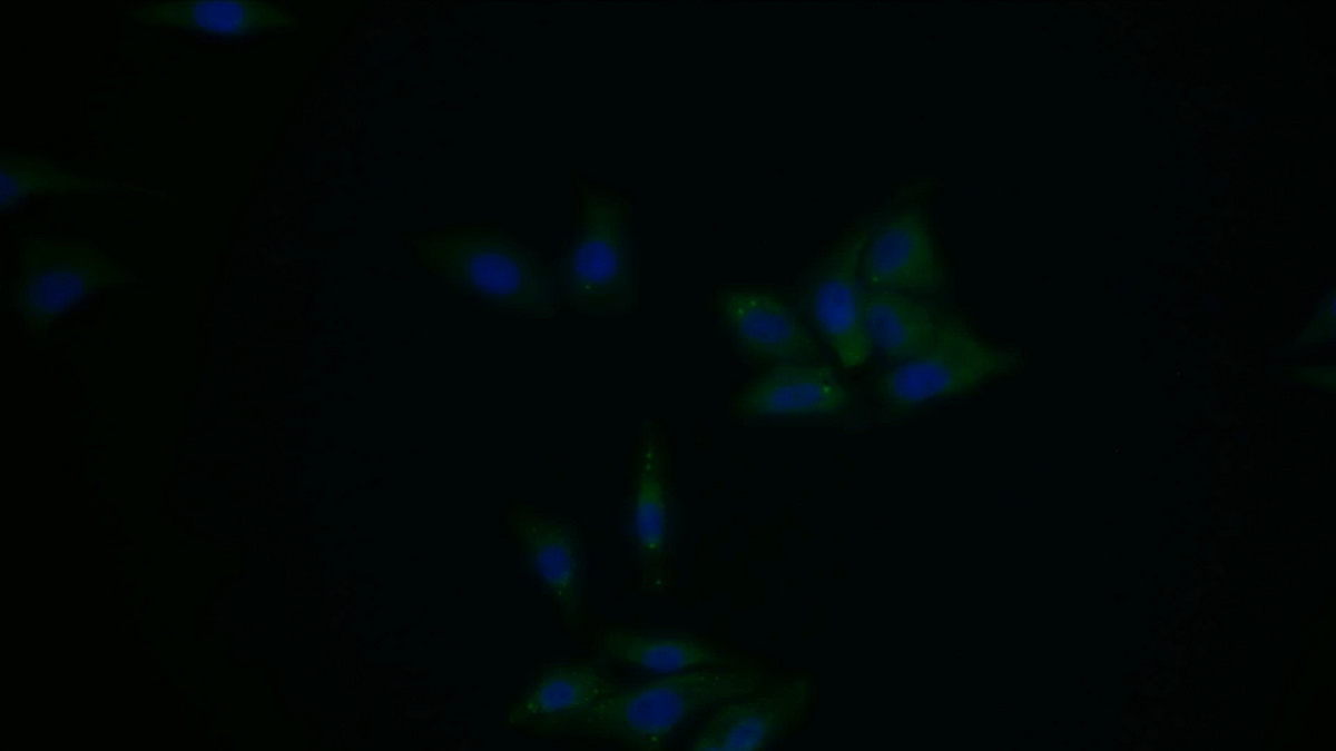 Polyclonal Antibody to Low Density Lipoprotein Receptor Related Protein 11 (LRP11)