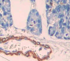 Polyclonal Antibody to Low Density Lipoprotein Receptor Related Protein 3 (LRP3)