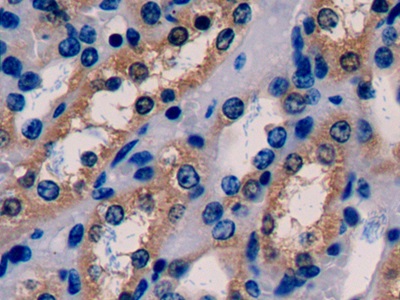 Polyclonal Antibody to Glutathione Synthetase (GSS)