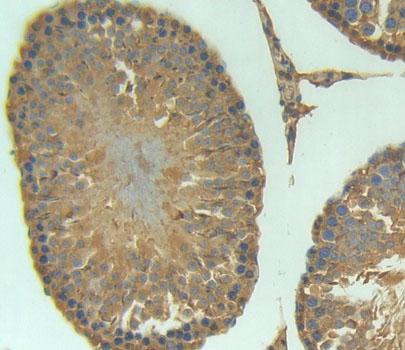 Polyclonal Antibody to Arginine Vasopressin Induced Protein 1 (AVPI1)