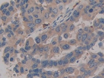 Polyclonal Antibody to Preprovasopressin (VP)