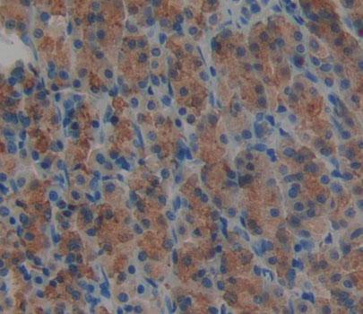 Polyclonal Antibody to Deoxythymidylate Kinase (DTYMK)