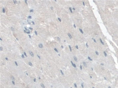 Polyclonal Antibody to Tryptase Beta 2 (TPSb2)